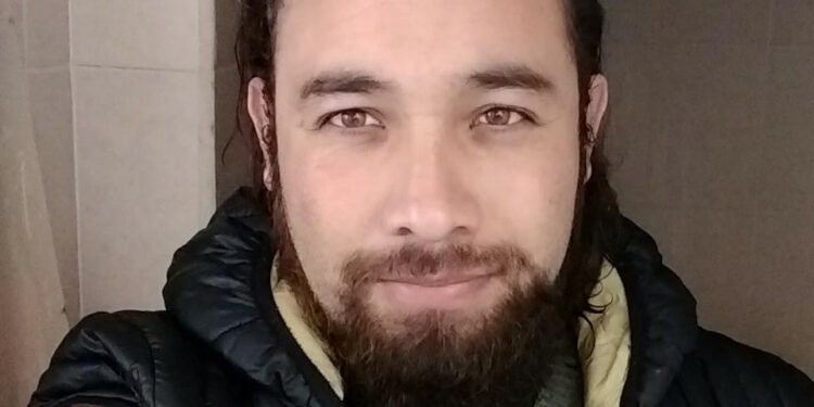 Estudiante de la UAEM recibe disparo en la frente durante fiesta bienvenida