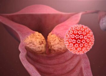 VPH debe ser prevenido desde la infancia