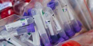 ONU apoya la nueva iniciativa global para garantizar la gratuidad de la vacuna contra el coronavirus