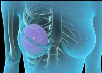 Buscan incorporar la reconstrucción mamaria en los servicios públicos de salud